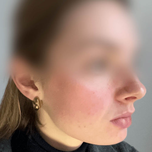 files/AGATHE_AFTER_1__4x5_BLUR_LR_500x500_1.jpg